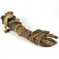 Mummy forearm